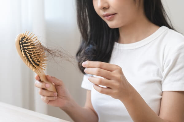 女性の薄毛治療